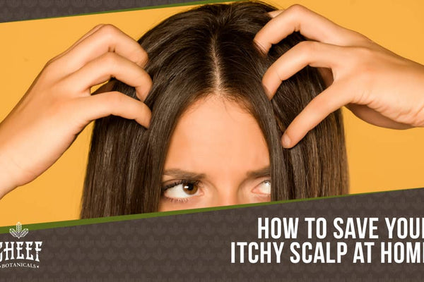 Home Remedies for Itchy Scalp: Stop Scratching Today!