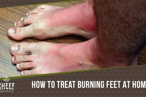 Home Remedies for Burning Feet: 12 Easy Ways to Soothe Your Feet