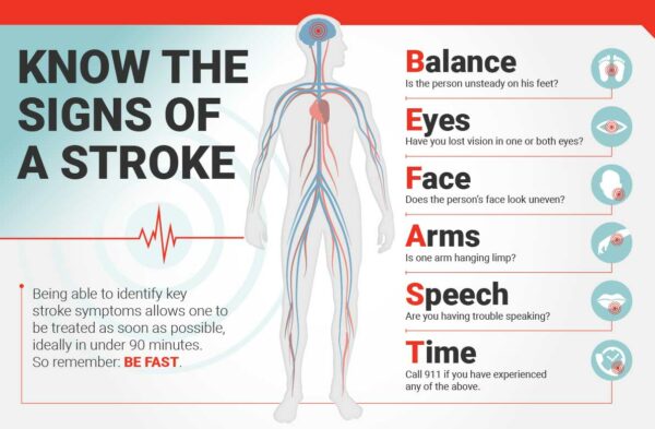 Using CBD Oil For Stroke Recovery In Patients [PROVEN] | Cheef